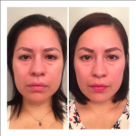 BEFORE & AFTER