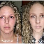 BEFORE & AFTER
