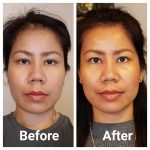 BEFORE & AFTER
